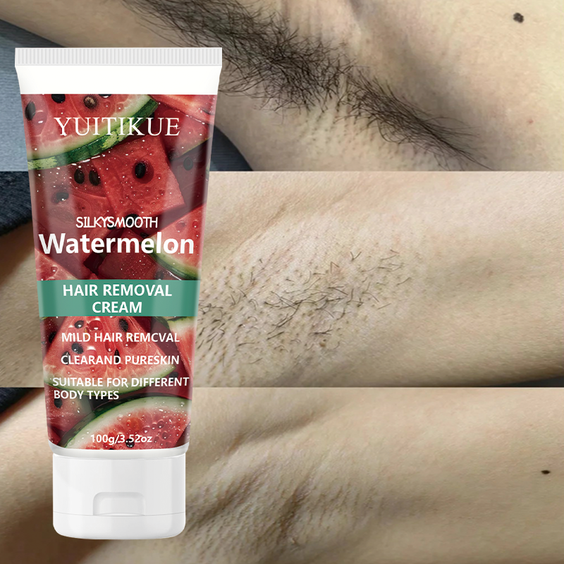 YUITIKUE Watermelon Hair Remov – Hair Removal Cream Bewertung und Preis