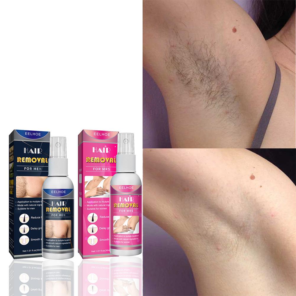 1/2PCS Super Natural Painless  – Hair Removal Cream Bewertung und Preis